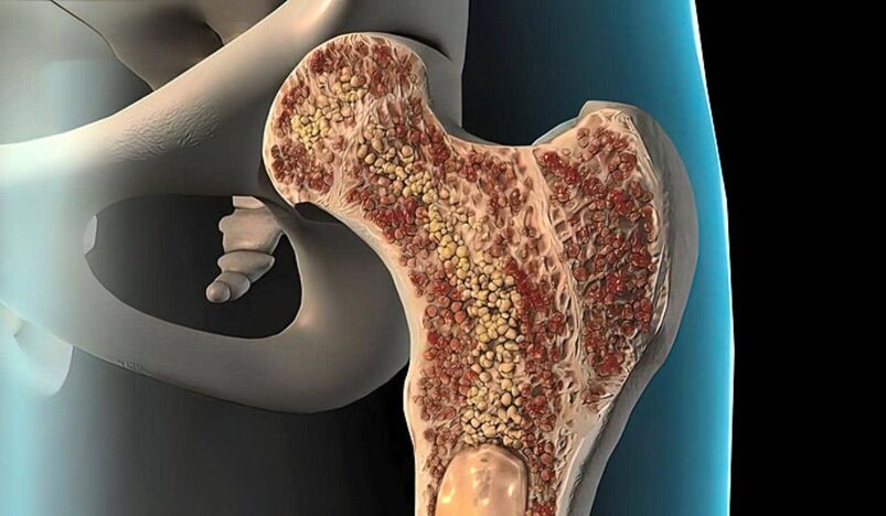 Why Bone Marrow Matters